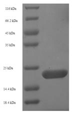 Greater than 90% as determined by SDS-PAGE.Recombinant Human Aquaporin-4 (AQP4) Protein (His-SUMO)