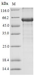 Greater than 90% as determined by SDS-PAGE.Recombinant Human Androgen Receptor (AR) Protein (His-SUMO&Myc)