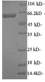 Greater than 90% as determined by SDS-PAGE.Recombinant Human Arylsulfatase B (ARSB) Protein (His-SUMO)