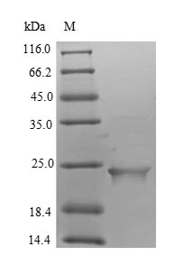 Greater than 90% as determined by SDS-PAGE.Recombinant Human Putative Inactive Neutral Ceramidase B (ASAH2B) Protein (His)