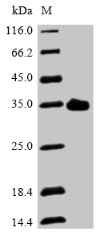 Greater than 85% as determined by SDS-PAGE.Recombinant Mouse Asialoglycoprotein Receptor 2 (ASGR2) Protein (His&Myc)
