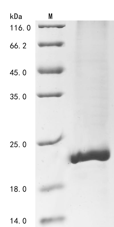 Greater than 85% as determined by SDS-PAGE.Recombinant Human Agouti-Signaling Protein (ASIP) Protein (His&Myc)