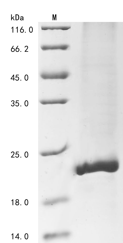 Greater than 85% as determined by SDS-PAGE.Recombinant Human Agouti-Signaling Protein (ASIP) Protein (His&Myc)