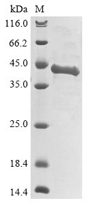 Greater than 85% as determined by SDS-PAGE.Recombinant Human Agouti-Signaling Protein (ASIP) Protein (His-GST)