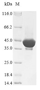 Greater than 85% as determined by SDS-PAGE.Recombinant Human Acetylserotonin O-Methyltransferase (ASMT) Protein (His&Myc)