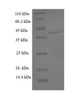 Greater than 90% as determined by SDS-PAGE.Recombinant Human Aspartyl/Asparaginyl Beta-Hydroxylase (ASPH) Protein (His-SUMO)