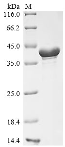 Greater than 85% as determined by SDS-PAGE.Recombinant Mouse Cyclic Amp-Dependent Transcription Factor Atf-5 (ATF5) Protein (His&Myc)