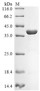 Greater than 85% as determined by SDS-PAGE.Recombinant Mouse Cyclic Amp-Dependent Transcription Factor Atf-5 (ATF5) Protein (His)