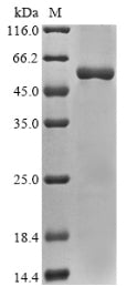 Greater than 85% as determined by SDS-PAGE.Recombinant Rat Sodium/Potassium-Transporting Atpase Subunit Alpha-3 (ATP1A3) Protein (His&Myc)