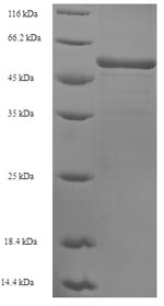 Greater than 90% as determined by SDS-PAGE.Recombinant Human Sarcoplasmic/Endoplasmic Reticulum Calcium Atpase 2 (ATP2A2) Protein (His)