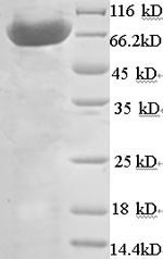 Greater than 90% as determined by SDS-PAGE.Recombinant Mouse Atp Synthase Subunit Beta, Mitochondrial (ATP5B) Protein (His-SUMO)
