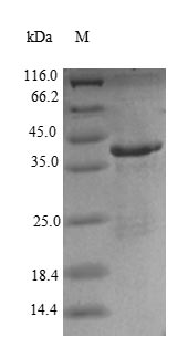 Greater than 90% as determined by SDS-PAGE.Recombinant Human Renin Receptor (ATP6AP2) Protein (His)