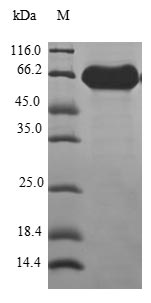Greater than 90% as determined by SDS-PAGE.Recombinant Human V-Type Proton Atpase Subunit D 1 (ATP6V0D1) Protein (GST)