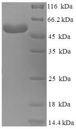 Greater than 90% as determined by SDS-PAGE.Recombinant Human Branched-Chain-Amino-Acid Aminotransferase, Mitochondrial (BCAT2) Protein (His-SUMO)