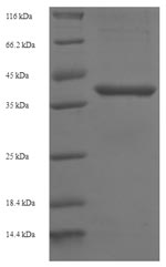 Greater than 90% as determined by SDS-PAGE.Recombinant Human B-Cell Lymphoma/Leukemia 10 (BCL10) Protein (His-SUMO)
