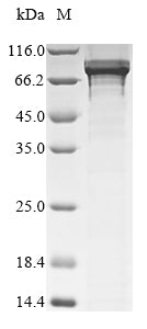Greater than 90% as determined by SDS-PAGE.Recombinant Human B-Cell Lymphoma 6 Protein (BCL6) Protein (GST)