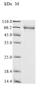 Greater than 85% as determined by SDS-PAGE.Recombinant Human B-Cell Lymphoma 6 Protein (BCL6) Protein (His-SUMO)