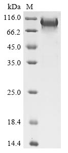 Greater than 90% as determined by SDS-PAGE.Recombinant Human B-Cell Lymphoma 6 Protein (BCL6) Protein (His)