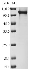 Greater than 85% as determined by SDS-PAGE.Recombinant Human B-Cell Lymphoma 6 Protein (BCL6)