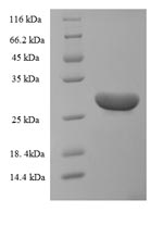 Greater than 90% as determined by SDS-PAGE.Recombinant Human Brain-Derived Neurotrophic Factor (BDNF) Protein (His-SUMO)