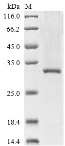 Greater than 85% as determined by SDS-PAGE.Recombinant Human Brain-Derived Neurotrophic Factor (BDNF) Protein (His-Myc)
