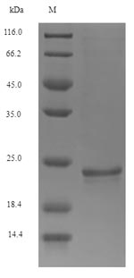Greater than 90% as determined by SDS-PAGE.Recombinant Mouse Osteocalcin (BGLAP) Protein (His-SUMO)