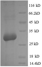 Greater than 90% as determined by SDS-PAGE.Recombinant Rat Osteocalcin (BGLAP) Protein (GST)
