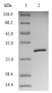 Greater than 90% as determined by SDS-PAGE.Recombinant Human Baculoviral Iap Repeat-Containing Protein 5 (BIRC5) Protein (His-SUMO)