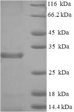 Greater than 90% as determined by SDS-PAGE.Recombinant Mouse Baculoviral Iap Repeat-Containing Protein 5 (BIRC5) Protein (His-SUMO)