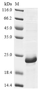 Greater than 85% as determined by SDS-PAGE.Recombinant Mouse Baculoviral Iap Repeat-Containing Protein 5 (BIRC5) Protein (His)