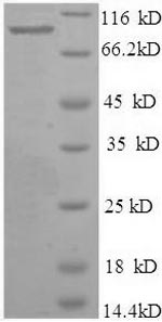Greater than 90% as determined by SDS-PAGE.Recombinant Human Bone Morphogenetic Protein 1 (BMP1) Protein (His)