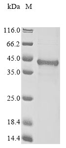 Greater than 85% as determined by SDS-PAGE.Recombinant Human Bcl2/Adenovirus E1B 19 Kda Protein-Interacting Protein 3-Like (BNIP3L) Protein (His&Myc)