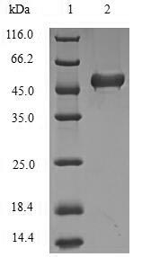 Greater than 90% as determined by SDS-PAGE.Recombinant Human Lys-63-Specific Deubiquitinase Brcc36 (BRCC3) Protein (His-SUMO)