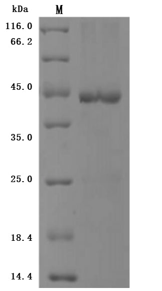 Greater than 85% as determined by SDS-PAGE.Recombinant Human Bromodomain-Containing Protein 4 (BRD4) Protein (His-GST)