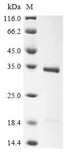 Greater than 85% as determined by SDS-PAGE.Recombinant Bovine Butyrophilin Subfamily 1 Member A1 (BTN1A1) Protein (His)