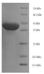 Greater than 90% as determined by SDS-PAGE.Recombinant Human Butyrophilin Subfamily 3 Member A1 (BTN3A1) Protein (His-SUMO)