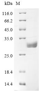 Greater than 90% as determined by SDS-PAGE.Recombinant Human Butyrophilin Subfamily 3 Member A1 (BTN3A1) Protein (His)