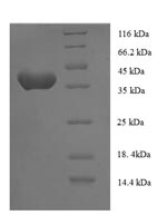 Greater than 90% as determined by SDS-PAGE.