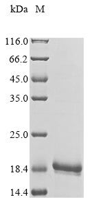 Greater than 90% as determined by SDS-PAGE.Recombinant Human V-Set And Transmembrane Domain-Containing Protein 5 (VSTM5) Protein (His)