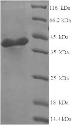 Greater than 90% as determined by SDS-PAGE.Recombinant Human Complement C1Q Subcomponent Subunit A (C1QA) Protein (His-SUMO)