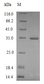 Greater than 85% as determined by SDS-PAGE.Recombinant Mouse Complement C1Q Subcomponent Subunit A (C1QA) Protein (His)
