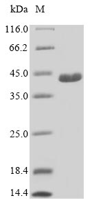 Greater than 85% as determined by SDS-PAGE.Recombinant Human Cilia- And Flagella-Associated Protein 410 (C21ORF2)