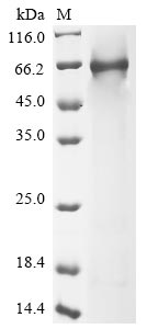 Greater than 85% as determined by SDS-PAGE.Recombinant Human Complement Component C8 Alpha Chain (C8A) Protein (His)