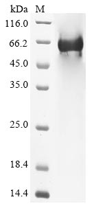 Greater than 85% as determined by SDS-PAGE.Recombinant Human Complement Component C8 Beta Chain (C8B) Protein (His)