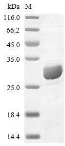 Greater than 85% as determined by SDS-PAGE.Recombinant Human Complement Component C8 Gamma Chain (C8G) Protein (His)