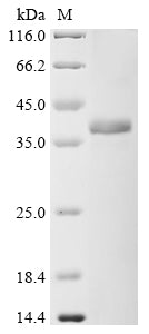 Greater than 85% as determined by SDS-PAGE.Recombinant Human Complement Component C9 (C9) Protein (His&Myc)
