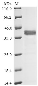 Greater than 90% as determined by SDS-PAGE.Recombinant Human Complement Component C9 (C9) Protein (His-GST)