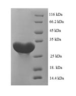 Greater than 90% as determined by SDS-PAGE.Recombinant Rat Carbonic Anhydrase 1 (CA1) Protein (His)
