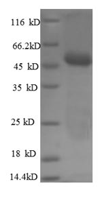 Greater than 90% as determined by SDS-PAGE.Recombinant Human Carbonic Anhydrase 12 (CA12) Protein (His-SUMO)