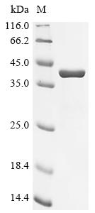 Greater than 90% as determined by SDS-PAGE.Recombinant Human Carbonic Anhydrase 6 (CA6) Protein (His&Myc)